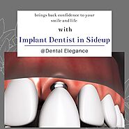 Implant Dentist Sidcup