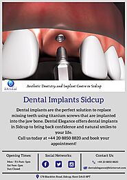 Dental Implants Sidcup