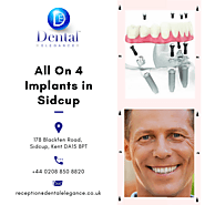 All On 4 Implants Sidcup