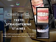 Teeth Straightening Staines