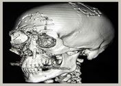 Get an insight about head injury and when to call for medical help!