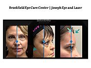 Brookfield Eye Care Center | Joseph Eye and Laser