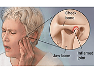 Jaw Pain / Clenching and Grinding Relief Dental service in Australia | AdmireDentistry