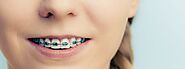 5 Common Braces Emergencies and Dentist Recommended Home Treatments