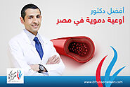 افضل دكتور اوعية دموية في مصر | الدكتور حسين علوان