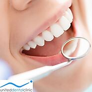 Things to Keep in Mind While Choosing Teeth Whitening Services | Passive News