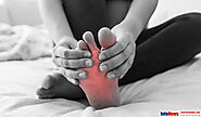 Những bài tập chữa bệnh suy giãn tĩnh mạch chân nên biết