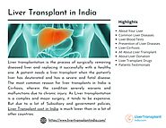 Most Reliable Liver Transplant in India