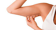 Arm Lift - Reduce Or Eliminate Excess Skin