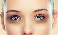 A Comprehensive Guide on Dark Circles and Its Treatments