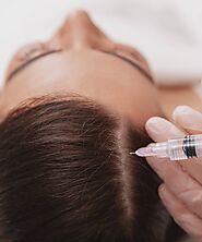 PRP Treatment Toronto - Platelet Rich Plasma for Your Skin & Hair