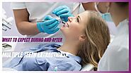Get Extensive Dental Care Treatment