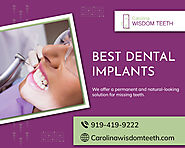 Surgical Solutions for Missing Teeth