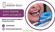 Proficient Tooth Extraction Treatment