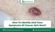 Here You Know about different types of Cancer that may cause Skin Rash?