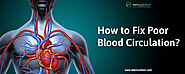 How to fix poor blood circulation? Causes, Symptoms and prevention