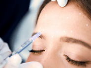 Reputed botox clinic in Toronto