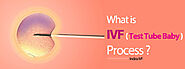 Test Tube Baby Process and Procedure | IVF Test Tube Baby | Indira IVF