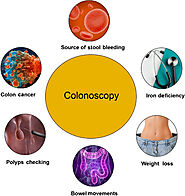 Colonoscopy Bowel Preparation Drugs Market to Surpass US$ 2.4 Billion, Globally, by the End of 2027 - Coherent Market...