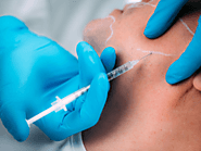 Professional Dermal fillers in Toronto