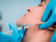 Best Dermal Fillers in Toronto