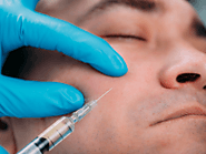 Professional Dermal fillers in Toronto