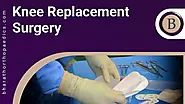 Best Knee Replacement Surgery In Chennai