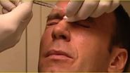 Doctor: Botox gains popularity with men