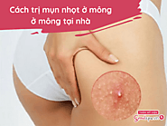 Bật mí 16 cách trị mụn nhọt ở mông ở mông tại nhà hiệu quả nhanh nhất