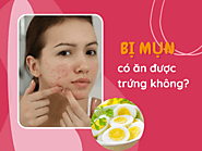 Bị mụn có nên ăn trứng? Những thực phẩm cần kiêng khi bị mụn