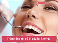 Trám răng rồi có bị sâu lại không? Chăm sóc thế nào để không sâu răng?