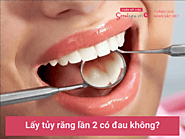 Lấy tủy răng lần 2 có đau không? Bí quyết không cần lấy tủy răng nhiều lần