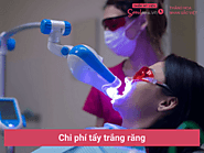 Chi phí tẩy trắng răng là bao nhiêu? Bảng giá mới nhất