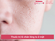 Tiết lộ 10 loại thuốc trị lỗ chân lông to ở mặt đáng mua hiện nay