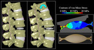 Using FEA to Understand the Behavior of Human Lumbar Spine