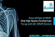 Janta Xray Clinic in Tilak Nagar Discount Upto 60% :Get Prices & Discount Offers-Lab Uncle
