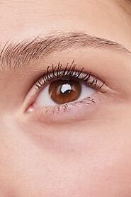 How Long Does Upper Eyelid Surgery Take?