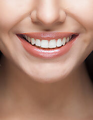 Teeth Whitening Gravesend, Dartford, Maidstone and Meopham - Meopham Dental Care