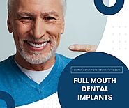 Dental Implants NYC | Immediate Dental Implants Brooklyn, NY