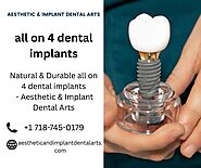 Dental Implants NYC | Immediate Dental Implants Brooklyn, NY