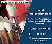 Transform Your Smile with Ceramic Dental Implants in Brooklyn