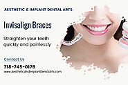 Invisalign braces Brooklyn NY