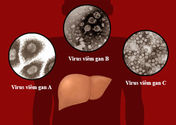 Chuyên đề: Viêm gan C: 'Bệnh thầm lặng' nguy hiểm - Songkhoe.vn - page 1