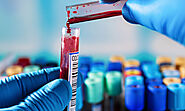 Biochemistry SGPT Blood Tests in Gurgaon - MDRC India