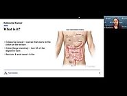 The Journey of Colorectal Cancer Treatment Simplified