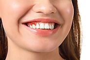 Tips for Preventing Symptoms of Gum Disease