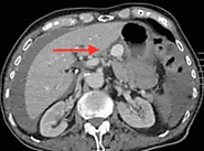 Clinical Images and Case Reports Journal