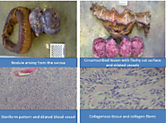 Clinical Images and Case Reports Journal