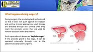 Transurethral Resection of the Prostate TURP Surgery in Kota
