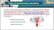 Laparoscopic Assisted Vaginal Hysterectomy Surgery – Dr. Jindal